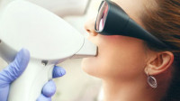 Laser Hair Removal